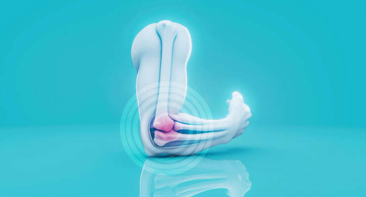 Pain Management